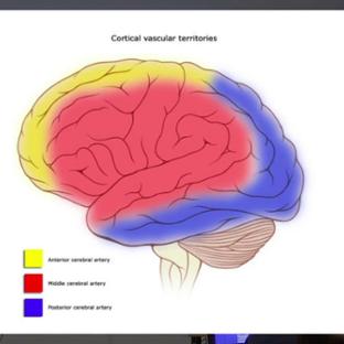 TVB Node 6 - Berlin: Randy McIntosh - Clinical applications of The Virtual Brain