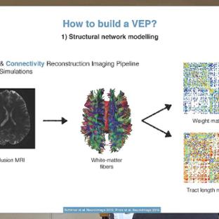 TVB Node 6 - Berlin: Julie Courtiol - Clinical applications of The Virtual Brain - Epilepsy