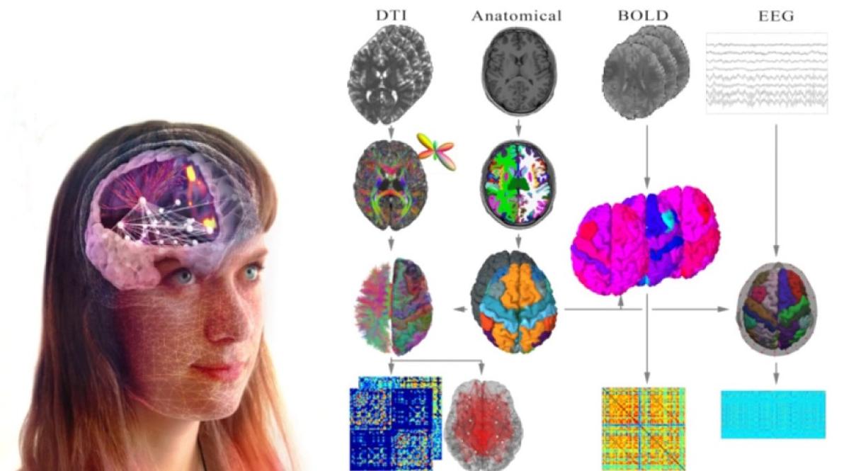 Automated Pipeline for creating Individualised brain models